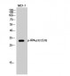 RPA p32 (phospho Ser33) Polyclonal Antibody